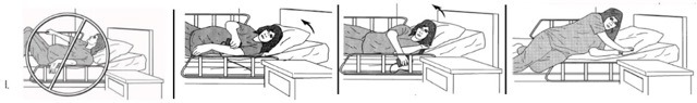Correct technique for getting out of bed after C-section