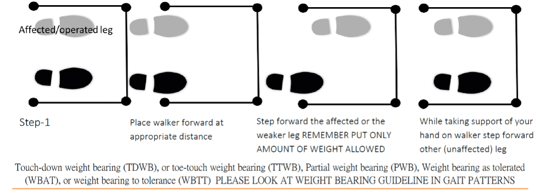 Weight Bearing Instructions